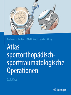 Atlas sportorthopädisch-sporttraumatologische Operationen von Feucht,  Matthias J., Imhoff,  Andreas B.
