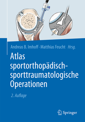 Atlas sportorthopädisch-sporttraumatologische Operationen von Feucht,  Matthias J., Imhoff,  Andreas B.