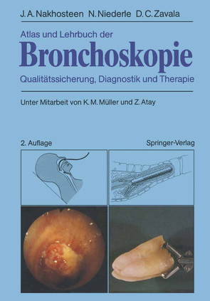 Atlas und Lehrbuch der Bronchoskopie von Atay,  Z., Müller,  K.-M., Nakhosteen,  John A., Niederle,  Norbert, Zavala,  Donald C.