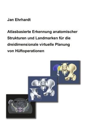 Atlasbasierte Erkennung anatomischer Strukturen und Landmarken für die dreidimensionale virtuelle Planung von Hüftoperationen von Ehrhardt,  Jan