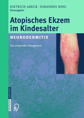 Atopisches Ekzem im Kindesalter (Neurodermitis) von Abeck,  D., Ring,  J.