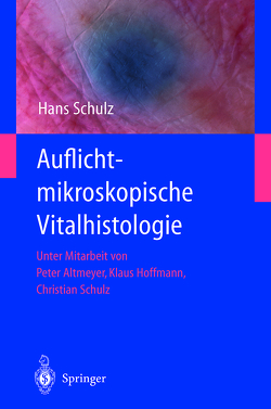 Auflichtmikroskopische Vitalhistologie von Altmeyer,  P., Hoffmann,  K, Schulz,  C., Schulz,  Hans