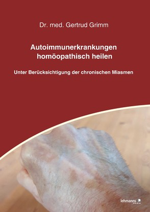 Autoimmunerkrankungen homöopathisch heilen von Grimm,  Gertrud