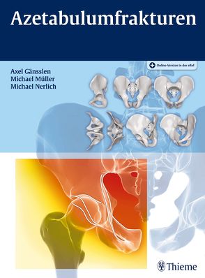 Azetabulumfrakturen von Gänsslen,  Axel, Mueller,  Michael, Nerlich,  Michael