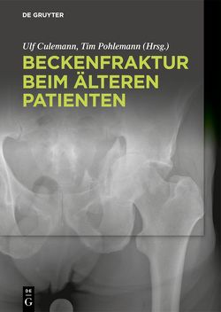 Beckenfraktur beim älteren Patienten von Culemann,  Ulf, Pohlemann,  Tim