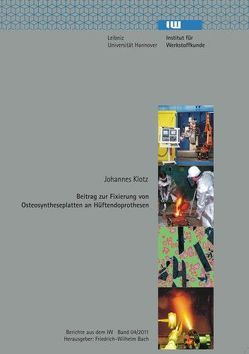 Beitrag zur Fixierung von Osteosyntheseplatten an Hüftendoprothesen von Bach,  Friedrich-Wilhelm, Klotz,  Johannes