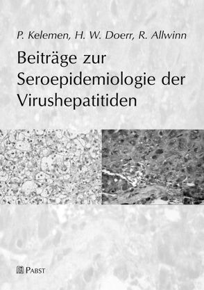 Beiträge zur Seroepidemiologie der Virushepatitiden von Allwinn,  R, Doerr,  H.W., Kelemen,  P