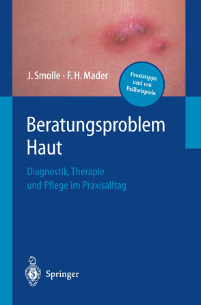 Beratungsproblem Haut von Mader,  Frank H., Smolle,  Josef