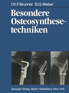 Besondere Osteosynthesetechniken von Brunner,  C. F., Weber,  B. G.