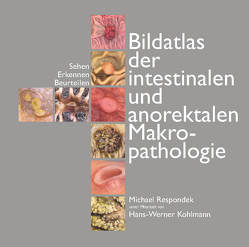 Bildatlas der intestinalen und anorektalen Makropathologie von Dr. Respondek,  Michael