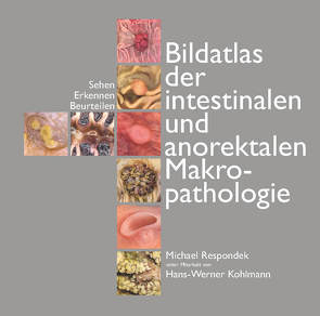 Bildatlas der intestinalen und anorektalen Makropathologie von Respondek,  Michael