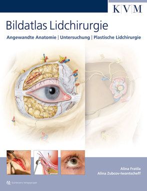 Bildatlas Lidchirurgie von Fratila,  Alina, Zubcov-Iwantscheff,  Alina