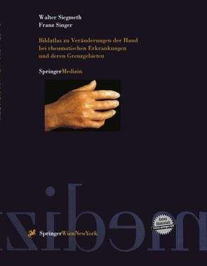 Bildatlas zu Veränderungen der Hand bei rheumatischen Erkrankungen und deren Grenzgebieten von Siegmeth,  Walter, Singer,  Franz