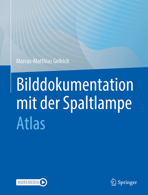 Bilddokumentation mit der Spaltlampe von Gellrich,  Marcus-Matthias