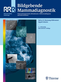 Bildgebende Mammadiagnostik von Heywang-Köbrunner,  Sylvia H., Schreer,  Ingrid