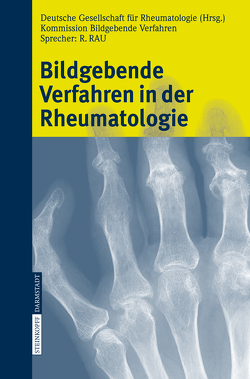 Bildgebende Verfahren in der Rheumatologie von Deutsche Gesellschaft für Rheumatologie - Kommission Bildgebende Verfahren
