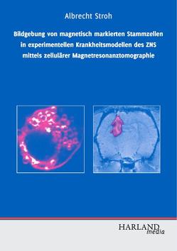 Bildgebung von magnetisch markierten Stammzellen in experimentellen Krankheitsmodellen des ZNS mittels zellulärer Magnetresonanztomographie von Stroh,  Albrecht