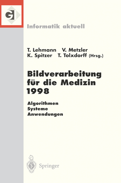 Bildverarbeitung für die Medizin 1998 von Lehmann,  Thomas, Metzler,  Volker, Spitzer,  Klaus, Tolxdorff,  Thomas