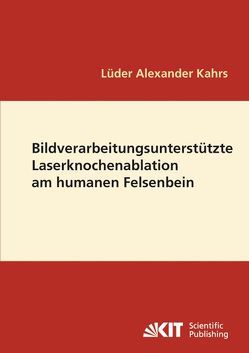 Bildverarbeitungsunterstützte Laserknochenablation am humanen Felsenbein von Kahrs,  Lüder A