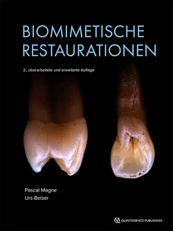 Biomimetische Restaurationen von Belser,  Urs C., Magne,  Pascal
