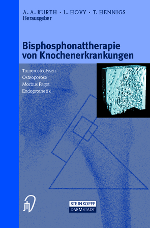 Bisphosphonattherapie von Knochenerkrankungen von Hennigs,  T., Hovy,  L., Kurth,  A.A.
