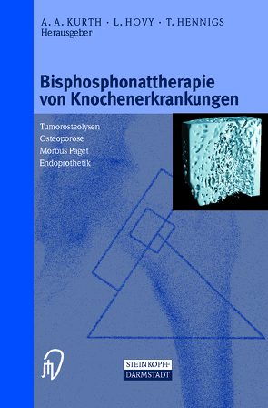 Bisphosphonattherapie von Knochenerkrankungen von Hennigs,  T., Hovy,  L., Kurth,  A.A.