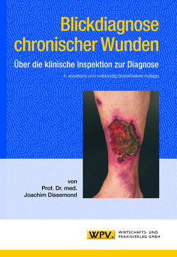 Blickdiagnose chronischer Wunden von Dissemond,  Joachim