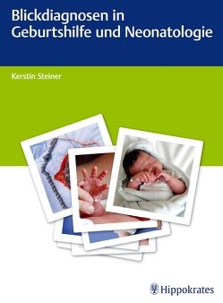 Blickdiagnosen in Geburtshilfe und Neonatologie von Steiner,  Kerstin
