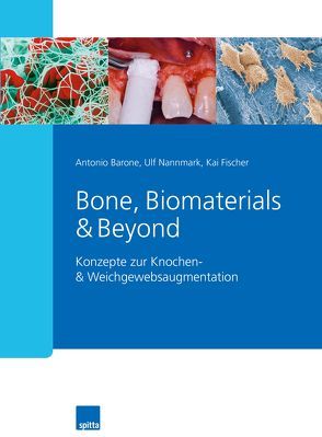 Bone, Biomaterials & Beyond von Barone,  Antonio, Fischer,  Kai, Nannmark,  Ulf