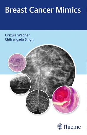 Breast Cancer Mimics von Singh,  Chitrangada, Wegner,  Urszula