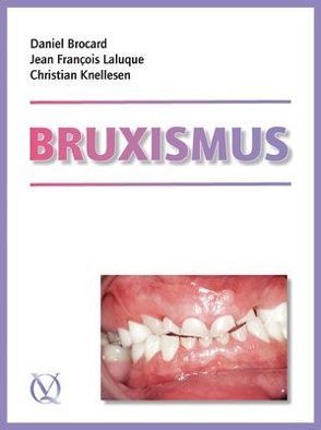 Bruxismus von Brocard,  Daniel, Knellesen,  Christian, Laluque,  Jean-Francois