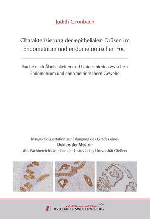 Charakterisierung der epithelialen Drüsen im Endometrium und endometriotischen Foci von Gronbach,  Judith