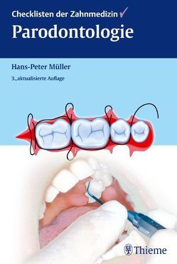 Checklisten der Zahnmedizin Parodontologie von Müller,  Hans Peter