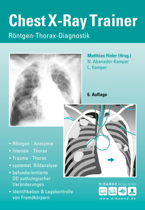 Chest-X-Ray Trainer von Abanador-Kamper,  Nadine, Hofer,  Matthias, Kamper,  Lars