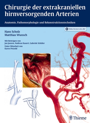 Chirurgie der extrakraniellen hirnversorgenden Arterien von Scholz,  Hans, Wunsch,  Matthias