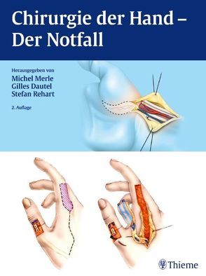 Chirurgie der Hand von Dautel,  Gilles, Merle,  Michel, Rehart,  Stefan