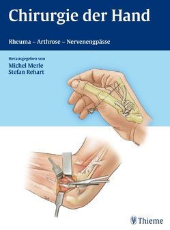 Chirurgie der Hand von Merle,  Michel, Rehart,  Stefan