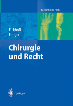 Chirurgie und Recht von Bünte,  H., Eickhoff,  Ulrich, Fenger,  Hermann