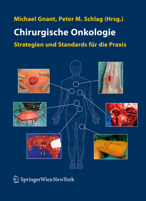 Chirurgische Onkologie von Gnant,  Michael, Schlag,  Peter M.