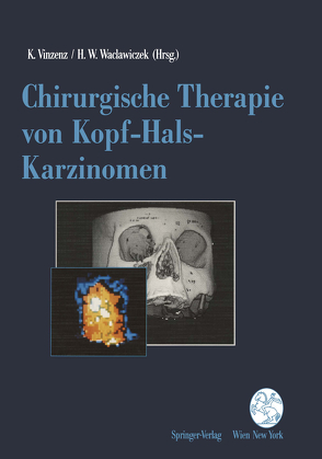 Chirurgische Therapie von Kopf-Hals-Karzinomen von Vinzenz,  Kurt, Waclawiczek,  Hans W.