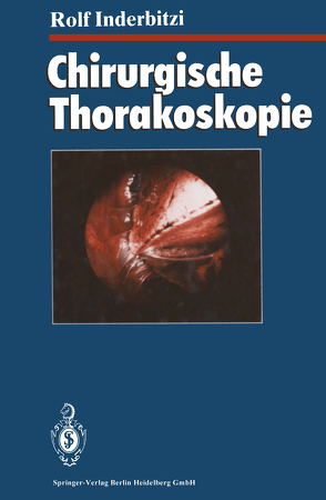 Chirurgische Thorakoskopie von Althaus,  U., Boutin,  C., Inderbitzi,  Rolf Gilbert Carl