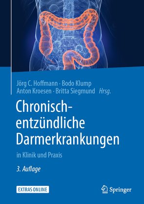 Chronisch-entzündliche Darmerkrankungen von Hoffmann,  Jörg C., Klump,  Bodo, Kroesen,  Anton, Siegmund,  Britta