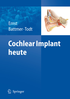 Cochlear Implant heute von Battmer,  Rolf-Dieter, Ernst,  Arne, Todt,  Ingo