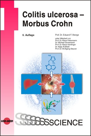 Colitis ulcerosa – Morbus Crohn von Stange,  Eduard F.