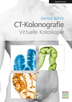 CT-Kolonografie von Böhm,  Gernot
