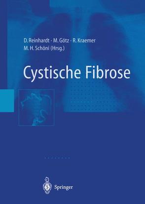Cystische Fibrose von Götz,  M., Kraemer,  R., Reinhardt,  D., Schöni,  M.