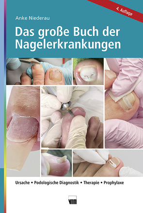 Das große Buch der Nagelerkrankungen von Niederau,  Anke