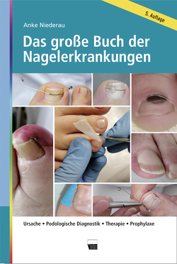Das große Buch der Nagelerkrankungen von Niederau,  Anke
