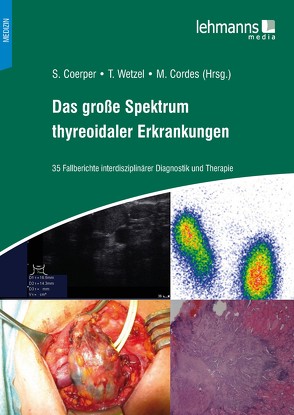 Das große Spektrum thyreoidaler Erkrankungen von Coerper,  Stephan, M.,  Cordes, Tobias,  Wetzel