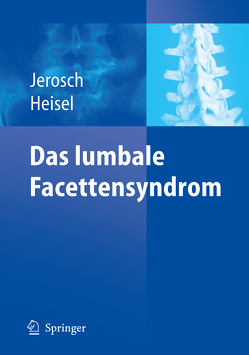 Das lumbale Facettensyndrom von Faustmann,  P.M., Heisel,  Jürgen, Jerosch,  Jörg, Schippers,  N.